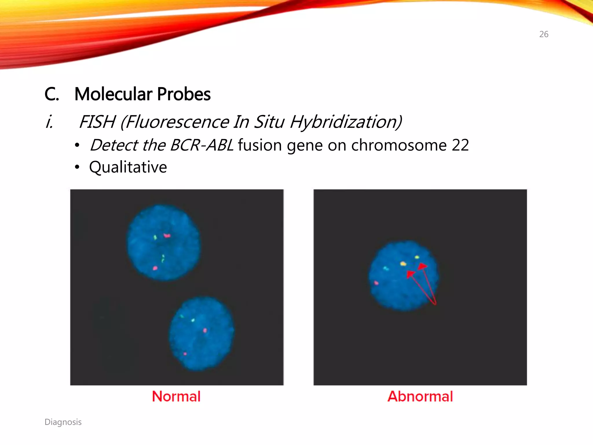 C. Molecular Probes
i. FISH (Fluorescence In Situ Hybridization)
• Detect the BCR-ABL fusion gene on chromosome 22
• Qualitative
Diagnosis
26
 
