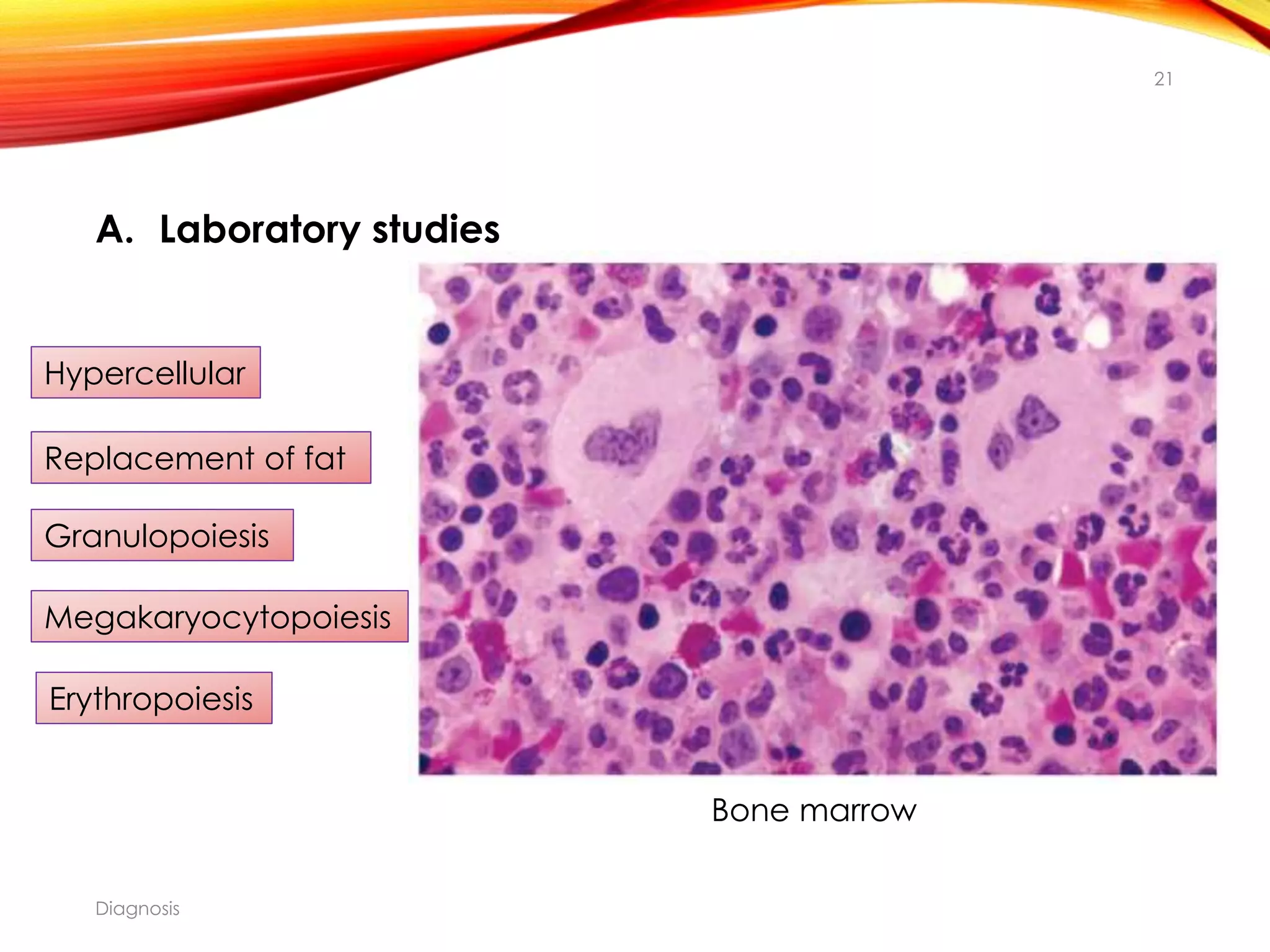 Chronic Myeloid Leukemia | PPTX