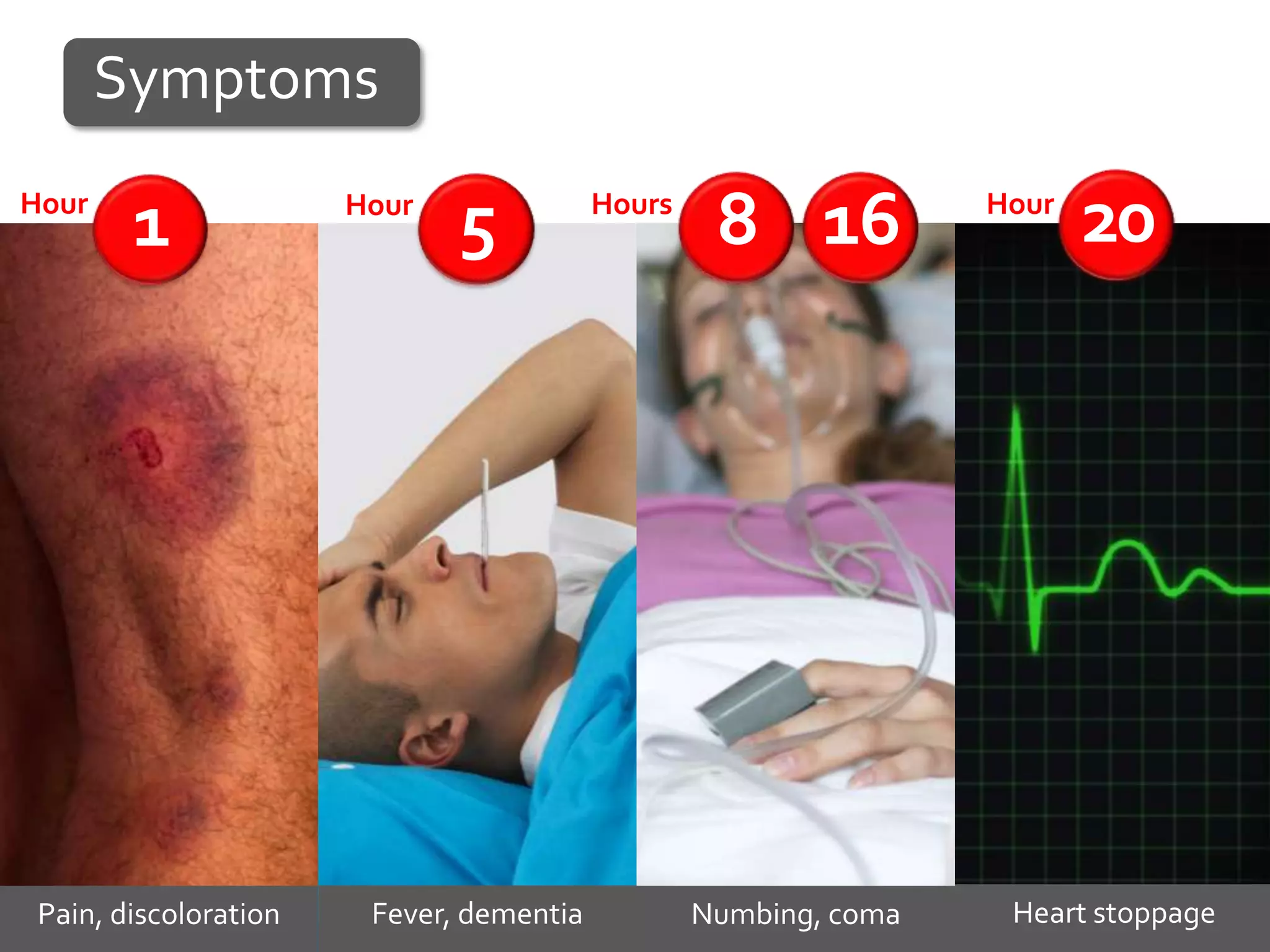Symptoms
Hour
        1              Hour
                              5           Hours
                                                   8 16           Hour
                                                                         20




 Pain, discoloration    Fever, dementia           Numbing, coma    Heart stoppage
 