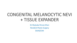 CONGENITAL MELANOCYTIC NEVI
+ TISSUE EXPANDER
Dr Mujtuba Pervez Khan
Resident Plastic Surgery
DUHS/CHK
 
