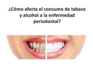 ¿Cómo afecta el consumo de tabaco
y alcohol a la enfermedad
periodontal?
 