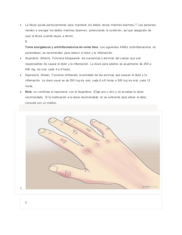 Cómo curar el dedo en gatillo