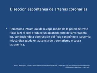 Diseccion espontanea de arterias coronarias



• Hematoma intramural de la capa media de la pared del vaso
  (falsa luz) el cual produce un aplanamiento de la verdadera
  luz, conduciendo a obstrucción del flujo sanguíneo e isquemia
  miocárdica aguda en ausencia de traumatismo o causa
  iatrogénica.




      Basso C, Morgagni G, Thiene G: Spontaneous coronary artery dissection: a neglected cause of acute myocardial ischaemia and
                                                                                          sudden death. Heart 1996; 75: 451-454.
 