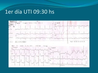 1er día UTI 09:30 hs
 