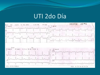 UTI 2do Día
 