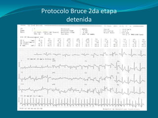 Protocolo Bruce 2da etapa
        detenida
 