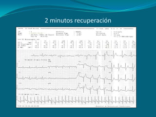 2 minutos recuperación
 