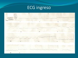 ECG ingreso
 