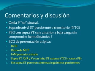 Comentarios y discusión
 Onda P “no” sinusal.
 Supradesnivel ST persistente o transitorio (NTG)
 PEG con supra ST cara anterior a baja carga sin
  compromiso hemodinámico ?
 ECG de presentación atípica:
1.   BCRI
2.   Ritmo de MCP
3.   IAM posterior aislado
4.   Supra ST AVR y V1 con infra ST extenso (TCI/3 vasos+FB)
5.   Sin supra ST pero con síntomas isquémicos persistentes
 