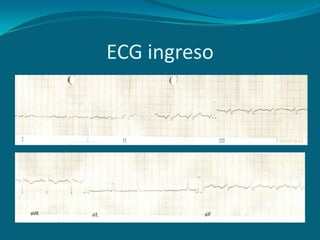 ECG ingreso
 