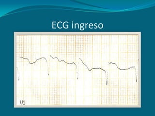 ECG ingreso
 