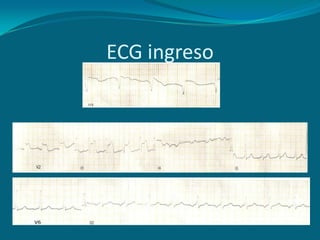 ECG ingreso
 