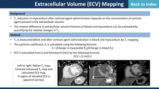 Extracellular Volume (ECV) Mapping
Background
• T1 reduction in myocardium after contrast agent administration depends on the concentration of contrast
agent present in the extracellular volume.
• The relative difference in extracellular volume fractions of blood and myocardium can be estimated by
quantifying the relative changes in T1.
Method
• T1 is measured before and after contrast agent administration in blood and myocardium by T1 mapping.
• The partition coefficient, λ, is calculated using the following formula:
λ = (Change in myocardial R1)/(Change in blood R1)
• ECV is calculated from λ and hematocrit (Hct) by the following formula:
ECV = (1-Hct) λ
Left to right: Native T1 map,
Contrast enhanced T1 map and
calculated ECV map.
A region of elevated ECV is
apparent (arrow).
Back to Index
 