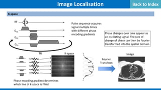 Image Localisation
K-space
K-space Image
Fourier
Transform
GSS
GPE
RF
GFE
TR
Pulse sequence acquires
signal multiple times
with different phase
encoding gradients
Phase encoding gradient determines
which line of k-space is filled
Phase changes over time appear as
an oscillating signal. The rate of
change of phase can then be Fourier
transformed into the spatial domain.
Back to Index
 