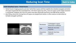 Reducing Scan Time
Under-Sampling k-space – Partial Fourier
• Partial Fourier imaging acquires just over half of the k-space and then exploits the complex conjugate symmetry
of k-space to generate the unsampled lines. The final k-space has all NPE lines of k-space so the image resolution
is maintained. However, less lines of k-space have been physically acquired so the SNR will be reduced.
• Zero filling, where the missing lines of k-space are assigned zero values, is often used as an alternative to
complex conjugate synthesis.
Resolution
Unchanged- k-space
dimensions unaltered
SNR
Reduced- less lines
acquired
Acquisition
time
Reduced- less lines
acquired
Back to Index
 
