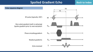Spoiled Gradient Echo
GSS
S
α °
RF
GPE
GFE
α°
TE
TR
Pulse sequence diagram
RF pulse (typically <90°)
Slice select gradient (with re-phasing)
Spoiler gradient prior to next excitation
Phase encoding gradient
Readout gradients
Echo received
Back to Index
 