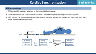 Cardiac Synchronisation
ECG Synchronisation
• MR compatible leads are attached to the patient before imaging.
• Software analyses the ECG trace to find the QRS complex and generates a synchronisation pulse.
• This initiates the pulse sequence controller so that the pulse sequence is applied at a given time after the R
wave, known as the trigger delay.
‘R’ wave
detection
software
Pulse
Sequence
controller
RF and
Gradient
amplifiers
ECG
‘R’-wave
ECG leads
Sync
pulse
Back to Index
 