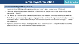 Cardiac Synchronisation
Conventional ECG Triggered Pulse Sequence
• In a conventional ECG triggered image acquisition one line of k-space is acquired per R-R interval.
• The trigger delay sets the phase of the cardiac cycle that is to be imaged (short trigger delay – systole, long
trigger delay – diastole).
• The TR must be a multiple of the R-R interval because the time between acquisitions is set by the heart rate.
• The technique generates a single image at a single point in the cardiac cycle. High resolution imaging is possible
because the image is constructed over multiple cardiac cycles. However, scan times will be long (TR x number
of k-space lines).
• In practice conventional imaging of a single cardiac phase as described here is not performed because of the
large proportion of time wasted whilst no data is being acquired.
Back to Index
 