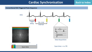 Cardiac Synchronisation
Conventional ECG Triggered Pulse Sequence
Data Acquisition
ECG
Trigger
delay
TR = R-R
interval
1 2 3 4
1
1234
Scan time
n
Scan time = n x TR
.
.
.
.
.
.
.
n
Back to Index
 