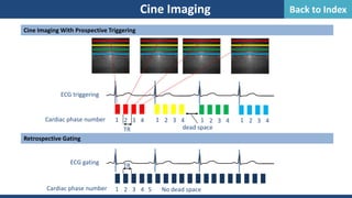 Cine Imaging
Cine Imaging With Prospective Triggering
Retrospective Gating
ECG triggering
TR dead space
1 2 3 4 1 2 3 4 1 2 3 4 1 2 3 4
Cardiac phase number
ECG gating
TR
No dead space
1 2 3 4 5
Cardiac phase number
Back to Index
 