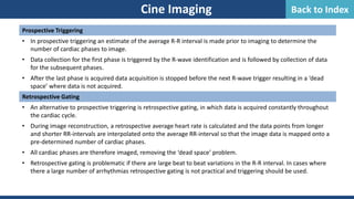 Cine Imaging
Prospective Triggering
• In prospective triggering an estimate of the average R-R interval is made prior to imaging to determine the
number of cardiac phases to image.
• Data collection for the first phase is triggered by the R-wave identification and is followed by collection of data
for the subsequent phases.
• After the last phase is acquired data acquisition is stopped before the next R-wave trigger resulting in a ‘dead
space’ where data is not acquired.
Retrospective Gating
• An alternative to prospective triggering is retrospective gating, in which data is acquired constantly throughout
the cardiac cycle.
• During image reconstruction, a retrospective average heart rate is calculated and the data points from longer
and shorter RR-intervals are interpolated onto the average RR-interval so that the image data is mapped onto a
pre-determined number of cardiac phases.
• All cardiac phases are therefore imaged, removing the ‘dead space’ problem.
• Retrospective gating is problematic if there are large beat to beat variations in the R-R interval. In cases where
there a large number of arrhythmias retrospective gating is not practical and triggering should be used.
Back to Index
 