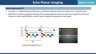 Echo Planar Imaging
Hybrid (Segmented) EPI
• In practice T2* dephasing means that there is insufficient signal to read all of k-space from a single RF pulse.
• Hybrid EPI is a half-way approach between EPI and spoiled gradient echo. An echo train length (ETL) of lines of
k-space are read using EPI before a new RF pulse is applied to generate the next signal.
 
GSS
GPE
RF
GFE
TR
Echo Train Length (ETL) = 5
Back to Index
 