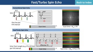 Fast/Turbo Spin Echo
Conventional Spin Echo
Fast/Turbo Spin Echo
ECG
R-R
Scan time = NPE x TR
One line per
R-R interval
ECG
R-R
Scan time n Scan time = (NPE / ETL) x TR
Echo Train Length (e.g. ETL=4) lines
per R-R interval
Scan time n
90o 180o
Effective TE
Back to Index
 