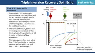 Triple IR SE – Blood And Fat
Suppression
• In some cases it is necessary to
suppress signal from both blood and
fat (e.g. oedema imaging). A third
slice selective inversion pulse
between the double IR preparation
and the image data acquisition can
be used to achieve this.
• The inversion time (TIfat) of the third
inversion pulse is selected so that
the longitudinal magnetisation of fat
is nulled at the time of data
acquisition.
• This techniques is often used with a
long TE for T2 weighting to visualise
oedema (as fluid, which has both
long T1 and T2, will be bright).
Triple Inversion Recovery Spin Echo
180° 180°
RF
Non-
selective
Slice-
selective
Image Data
Acquisition
Mz
TIblood
Blood flowing in
to slice is nulled
Fat is nulled
Stationary non-fatty
tissue has strong signal
180°
Slice-
selective
TIfat
Back to Index
 