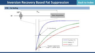 Inversion Recovery Based Fat Suppression
STIR – Fat Nulling
180°
RF Data Acquisition
TIfat
Back to Index
 