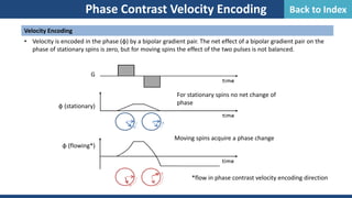 Phase Contrast Velocity Encoding
Velocity Encoding
• Velocity is encoded in the phase (φ) by a bipolar gradient pair. The net effect of a bipolar gradient pair on the
phase of stationary spins is zero, but for moving spins the effect of the two pulses is not balanced.
For stationary spins no net change of
phase
Moving spins acquire a phase change
G
φ (stationary)
φ (flowing*)
*flow in phase contrast velocity encoding direction
Back to Index
 