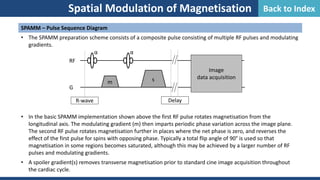 Spatial Modulation of Magnetisation
SPAMM – Pulse Sequence Diagram
• The SPAMM preparation scheme consists of a composite pulse consisting of multiple RF pulses and modulating
gradients.
• In the basic SPAMM implementation shown above the first RF pulse rotates magnetisation from the
longitudinal axis. The modulating gradient (m) then imparts periodic phase variation across the image plane.
The second RF pulse rotates magnetisation further in places where the net phase is zero, and reverses the
effect of the first pulse for spins with opposing phase. Typically a total flip angle of 90° is used so that
magnetisation in some regions becomes saturated, although this may be achieved by a larger number of RF
pulses and modulating gradients.
• A spoiler gradient(s) removes transverse magnetisation prior to standard cine image acquisition throughout
the cardiac cycle.
G
α α
RF
Image
data acquisition
R-wave Delay
m s
Back to Index
 