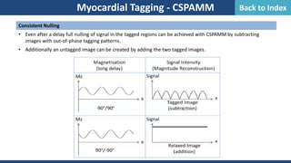 Consistent Nulling
• Even after a delay full nulling of signal in the tagged regions can be achieved with CSPAMM by subtracting
images with out-of-phase tagging patterns.
• Additionally an untagged image can be created by adding the two tagged images.
Myocardial Tagging - CSPAMM Back to Index
 