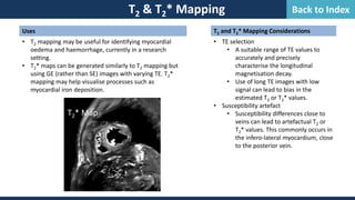 Uses
• T2 mapping may be useful for identifying myocardial
oedema and haemorrhage, currently in a research
setting.
• T2* maps can be generated similarly to T2 mapping but
using GE (rather than SE) images with varying TE. T2*
mapping may help visualise processes such as
myocardial iron deposition.
T2 & T2* Mapping
T2* Map
T2 and T2* Mapping Considerations
• TE selection
• A suitable range of TE values to
accurately and precisely
characterise the longitudinal
magnetisation decay.
• Use of long TE images with low
signal can lead to bias in the
estimated T2 or T2* values.
• Susceptibility artefact
• Susceptibility differences close to
veins can lead to artefactual T2 or
T2* values. This commonly occurs in
the infero-lateral myocardium, close
to the posterior vein.
Back to Index
 