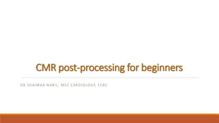 CMR post-processing for beginners
DR.SHAIMAA NABIL, MSC CARDIOLOGY, FEBC
 