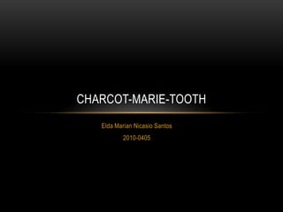 CHARCOT-MARIE-TOOTH
   Elda Marian Nicasio Santos
          2010-0405
 