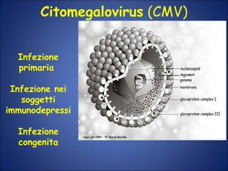 Citomegalovirus  (CMV) Infezione primaria  Infezione nei soggetti immunodepressi Infezione congenita 
