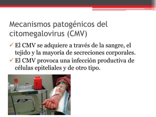 Mecanismos patogénicos del
citomegalovirus (CMV)
 El CMV se adquiere a través de la sangre, el
tejido y la mayoría de secreciones corporales.
 El CMV provoca una infección productiva de
células epiteliales y de otro tipo.
 
