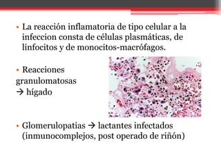 • La reacción inflamatoria de tipo celular a la
infeccion consta de células plasmáticas, de
linfocitos y de monocitos-macrófagos.
• Reacciones
granulomatosas
 hígado
• Glomerulopatias  lactantes infectados
(inmunocomplejos, post operado de riñón)
 