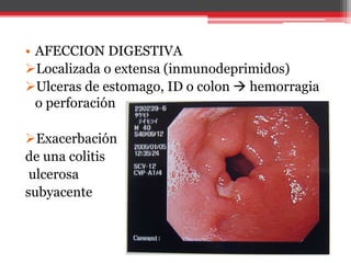 • AFECCION DIGESTIVA
Localizada o extensa (inmunodeprimidos)
Ulceras de estomago, ID o colon  hemorragia
o perforación
Exacerbación
de una colitis
ulcerosa
subyacente
 