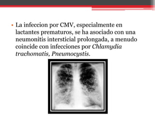 • La infeccion por CMV, especialmente en
lactantes prematuros, se ha asociado con una
neumonitis intersticial prolongada, a menudo
coincide con infecciones por Chlamydia
trachomatis, Pneumocystis.
 