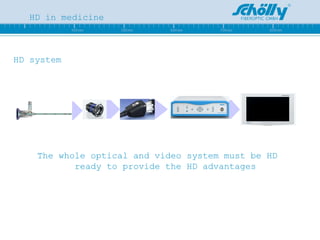 HD in medicine HD system The whole optical and video system must be HD ready to provide the HD advantages 