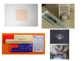 Cn – 9º  Ano (ContracepçãO)