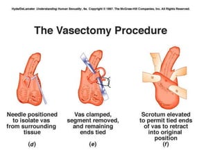 Cn – 9º  Ano (ContracepçãO)