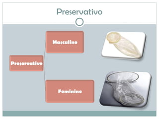 Preservativo
 