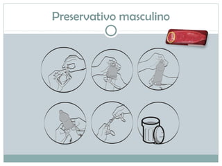 Preservativo masculino
 
