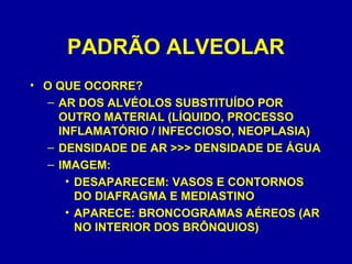 PADRÃO ALVEOLAR
• O QUE OCORRE?
– AR DOS ALVÉOLOS SUBSTITUÍDO POR
OUTRO MATERIAL (LÍQUIDO, PROCESSO
INFLAMATÓRIO / INFECCIOSO, NEOPLASIA)
– DENSIDADE DE AR >>> DENSIDADE DE ÁGUA
– IMAGEM:
• DESAPARECEM: VASOS E CONTORNOS
DO DIAFRAGMA E MEDIASTINO
• APARECE: BRONCOGRAMAS AÉREOS (AR
NO INTERIOR DOS BRÔNQUIOS)
 