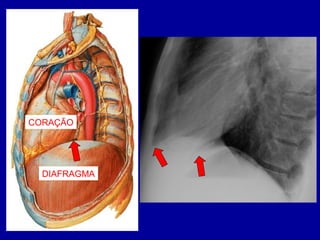 CORAÇÃO
DIAFRAGMA
 