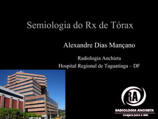 Semiologia do Rx de Tórax
Alexandre Dias Mançano
Radiologia Anchieta
Hospital Regional de Taguatinga – DF
 