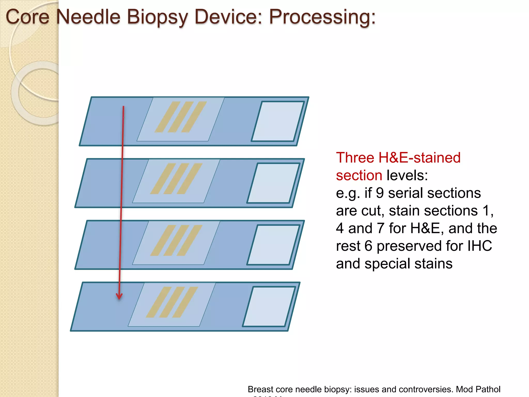 Core Needle Biopsy of Breast : Updates | PPTX
