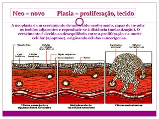 A neoplasia é um crescimento de um tecido neoformado, capaz de invadir
os tecidos adjacentes e reproduzir-se à distância (metastização). O
crescimento é devido ao desequilíbrio entre a proliferação e a morte
celular (apoptose), originando células cancerígenas.
Neo – novo Plasia – proliferação, tecidoNeo – novo Plasia – proliferação, tecido
 